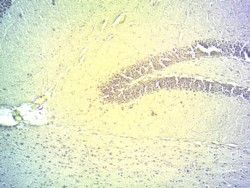 Immunohistochemical staining of PFA-fixed frozen-sectioned of Mouse Hippocampus using PA5-18659 at a concentration of 2 ug/ml. The tissue was processed by microwaved antigen retrieval with citrate buffer pH 4.5 and stained with HRP.