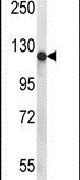 Western blot analysis using a PIGN polyclonal antibody (Product # PA5-26755) in mouse NIH-3T3 cell lysates (35ug per lane).