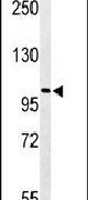 Western blot analysis using a PKHH2 polyclonal antibody (Product # PA5-26776) in Jurkat cell lysates (35ug per lane).