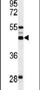 Western blot analysis using an OST alpha polyclonal antibody (Product # PA5-26837) in 293 cell lysates (35ug per lane).