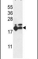 Western blot analysis using a RPL17 polyclonal antibody (Product # PA5-26889) in A375, HL-60 cell lysates (35ug per lane).
