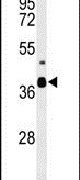 Western blot analysis using a CC058 polyclonal antibody (Product # PA5-26926) in mouse cerebellum tissue lysates (35ug per lane).