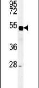 Western blot analysis using a SP5 polyclonal antibody (Product # PA5-26934) in mouse liver tissue lysates (35ug per lane).