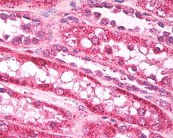 Immunohistochemistry analysis of formalin-fixed, paraffin-embedded human kidney stained using a FAM59A (C18orf11) polyclonal antibody (Product # PA5-23255) at 5 ug/ml. Staining of formalin-fixed tissues is enhanced by boiling tissue sections in 10 mM sodium citrate buffer, pH 6.0 for 10-20 min followed by cooling at RT for 20 min.