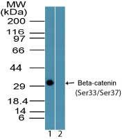 Western blot analysis of Beta-catenin (Ser33/Ser37) in recombinant fusion protein containing 1) phosphorylated serine residues at positions 33 and 37 and 2) unphosphorylated serine residues at positions 33 and 37, using a Phospho-Beta-catenin pSer33+Ser37 polyclonal antibody (Product # PA5-23354) at 0.25 ug/ml.