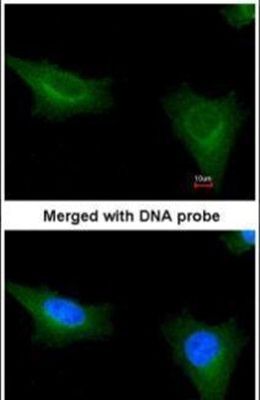 Immunofluorescent analysis of TTLL1 in paraformaldehyde-fixed HeLa cells using a TTLL1 polyclonal antibody (Product # PA5-27285) at a 1:200 dilution.