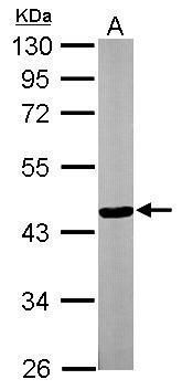 Western blot analysis of TTLL1 using 30µg of NIH-3T3 lysate. Samples were loaded onto a 10% SDS-PAGE gel and probed with a TTLL1 polyclonal antibody (Product # PA5-27285) at a dilution of 1:3000.