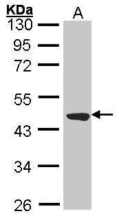 Western blot analysis of TTLL1 using 30µg of MOLT4 lysate. Samples were loaded onto a 10% SDS-PAGE gel and probed with a TTLL1 polyclonal antibody (Product # PA5-27285) at a dilution of 1:2000.