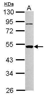 Western blot analysis of PIGA using 30µg of NIH-3T3 lysate. Samples were loaded onto a 10% SDS-PAGE gel and probed with a PIGA polyclonal antibody (Product # PA5-27740) at a dilution of 1:1000.