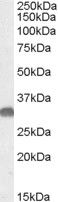 Western Blot staining of Mouse Brain lysate using PA5-18960 at a concentration of 0.05 ug/ml, the primary antibody incubation was 1 hour and the detection method was chemiluminescence.