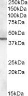 Western Blot staining of Mouse Brain lysate using PA5-18982 at a concentration of 0.3 ug/ ml, the primary antibody incubation was 1 hour and the detection method was chemiluminescence.