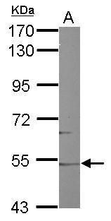 Western blot analysis of CYP46A1 using 50µg of mouse brain lysate. Samples were loaded onto a 7.5% SDS-PAGE gel and probed with a CYP46A1 polyclonal antibody (Product # PA5-28207) at a dilution of 1:1000.