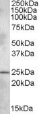 Western Blot staining of Rat Brain lysate using PA5-19042 at a concentration of 1.0 ug/ml, the primary antibody incubation was 1 hour and the detection method was chemiluminescence.