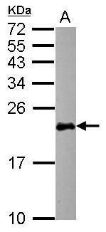 Western blot analysis of N-Ras using 50µg of mouse brain lysate. Samples were loaded onto a 12% SDS-PAGE gel and probed with a N-Ras polyclonal antibody (Product # PA5-28861) at a dilution of 1:1000.
