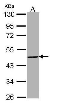 Western blot analysis of TBX19 using 30µg of HepG2 lysate. Samples were loaded onto a 10% SDS-PAGE gel and probed with a TBX19 polyclonal antibody (Product # PA5-28967) at a dilution of 1:5000.