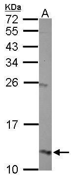 Western blot analysis of Hemoglobin gamma G using 30µg of U87-MG lysate. Samples were loaded onto a 15% SDS-PAGE gel and probed with a Hemoglobin gamma G polyclonal antibody (Product # PA5-29006) at a dilution of 1:500.