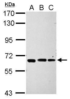 Western blot analysis of IPP using 30µg of A) NT2D1 (B) U87-MG and C) SK-N-SH lysate. Samples were loaded onto a 7.5% SDS-PAGE gel and probed with an IPP polyclonal antibody (Product # PA5-29510) at a dilution of 1:1000.