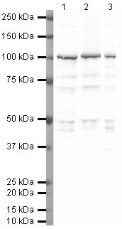 Western blot analysis of mouse Brain Tissue Lysate using PA5-19478, PSD95 (phospho T19) primary antibody at a dilution of 1 ug/ml (lane 1). PA5-19478 staining of Mouse Forebrain Tissue Lysate at a dilution of 1 ug/ml (Lane 2). PA5-19478 staining of Rat Brain Tissue Lysate at a dilution of 1 ug/ml (lane 3). Blot treated with a secondary HRP-conjugated Goat polyclonal anti-Rabbit antibody was used at a dilution of 1:3000.