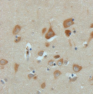 Immunohistochemical (formalin-fixed, paraffin-embedded) staining of Human Hippocampus tissue using PA5-19478, anti-PSD95 antibody. Primary antibody was used at a concentration of 1 ug/ml and exposed for 15 mins at room temp. The sample was pretreated using heat mediated antigen retrieval with Sodium Citrate Buffer (pH6 / 20mins). The detection method was a HRP conjugated polymer, DAB chromogen and the sample was counterstained with haematoxylin and mounted with DPX.