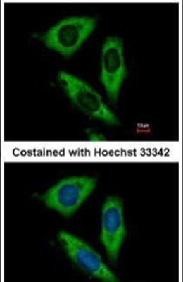 Immunofluorescent analysis of RPL24 in paraformaldehyde-fixed HeLa cells using a RPL24 polyclonal antibody (Product # PA5-30157) at a 1:500 dilution.