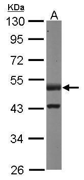Western blot analysis of PPP2R2D using 50µg of mouse brain lysate. Samples were loaded onto a 10% SDS-PAGE gel and probed with a PPP2R2D polyclonal antibody (Product # PA5-30763) at a dilution of 1:500.