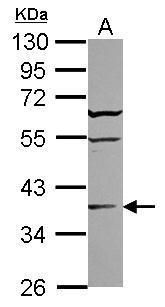 Western blot analysis of ST6GALNAC2 using 30µg of 293T lysate. Samples were loaded onto a 10% SDS-PAGE gel and probed with a ST6GALNAC2 polyclonal antibody (Product # PA5-31353) at a dilution of 1:3000.
