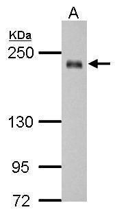 Western blot analysis of SSFA2 using 30µg of HCT116 lysate. Samples were loaded onto a 5% SDS-PAGE gel and probed with a SSFA2 polyclonal antibody (Product # PA5-31801) at a dilution of 1:1000.