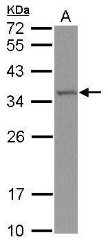 Western blot analysis of TRM61 using 30µg of NT2D1 lysate. Samples were loaded onto a 12% SDS-PAGE gel and probed with a TRM61 polyclonal antibody (Product # PA5-31452) at a dilution of 1:1000.