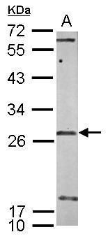 Western blot analysis of U1SNRNPBP using 50µg of mouse brain lysate. Samples were loaded onto a 12% SDS-PAGE gel and probed with a U1SNRNPBP polyclonal antibody (Product # PA5-31496) at a dilution of 1:1000.