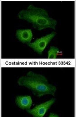 Immunofluorescent analysis of Olfactomedin-like 3 in methanol-fixed A549 cells using an Olfactomedin-like 3 polyclonal antibody (Product # PA5-31581) at a 1:500 dilution.
