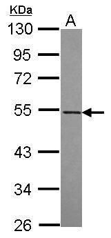 Western blot analysis of RASGEF1A using 30µg of A431 lysate. Samples were loaded onto a 10% SDS-PAGE gel and probed with a RASGEF1A polyclonal antibody (Product # PA5-31598) at a dilution of 1:1000.