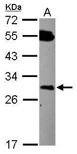 Western blot analysis of DCUN1D2 using 30µg of HCT116 lysate. Samples were loaded onto a 12% SDS-PAGE gel and probed with a DCUN1D2 polyclonal antibody (Product # PA5-31607) at a dilution of 1:1000.