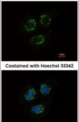 Immunofluorescent analysis of TTLL10 in methanol-fixed MCF-7 cells using a TTLL10 polyclonal antibody (Product # PA5-31631) at a 1:500 dilution.