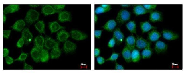 Immunofluorescent analysis of ALS2CR12 showing staining in the cytoplasm of A431 cells. A431 cells were fixed in ice-cold Methanol for 5 min and stained using an ALS2CR12 polyclonal antibody (Product # PA5-31636) diluted at 1:500. Blue: Hoechst 33343 staining.