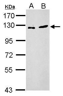 Western blot analysis of ZNF711 using 30µg of A) PC-3 and B) SK-N-SH lysate. Samples were loaded onto a 7.5% SDS-PAGE gel and probed with a ZNF711 polyclonal antibody (Product # PA5-31652) at a dilution of 1:2000.