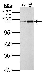 Western blot analysis of ZNF711 using 30µg of A) Non-transfected 293T lysates and B) ZNF711 transfected 293T lysates. Samples were loaded onto a 7.5% SDS-PAGE gel and probed with a ZNF711 polyclonal antibody (Product # PA5-31652) at a dilution of 1:5000.