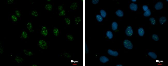 Immunofluorescent analysis of NPD014 showing staining in the nucleus of NT2D1 cells. NT2D1 cells were fixed in 4% paraformaldehyde at RT for 15 min and stained using a NPD014 polyclonal antibody (Product # PA5-31656) diluted at 1:500. Blue: Hoechst 33342 staining.