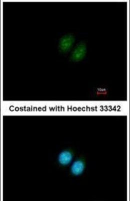 Immunofluorescent analysis of RRP12 in paraformaldehyde-fixed MCF-7 cells using a RRP12 polyclonal antibody (Product # PA5-31659) at a 1:200 dilution.