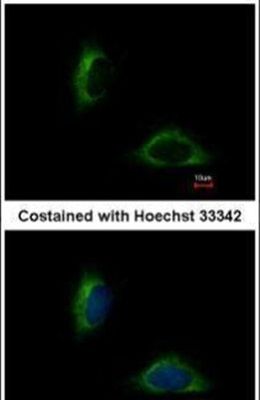 Immunofluorescent analysis of FAM171A1 in methanol-fixed HeLa cells using a FAM171A1 polyclonal antibody (Product # PA5-31666) at a 1:500 dilution.