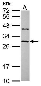 Western blot analysis of CCDC70 using 30µg of U87-MG lysate. Samples were loaded onto a 12% SDS-PAGE gel and probed with a CCDC70 polyclonal antibody (Product # PA5-31679) at a dilution of 1:1000.