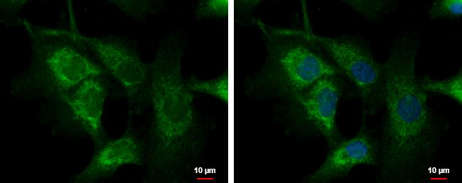 Immunofluorescent analysis of C1orf74 showing staining in the cytoplasm of U87-MG cells. U87-MG cells were fixed in 4% paraformaldehyde at RT for 15 min and stained using a C1orf74 polyclonal antibody (Product # PA5-31680) diluted at 1:1000. Blue: Hoechst 33342 staining.