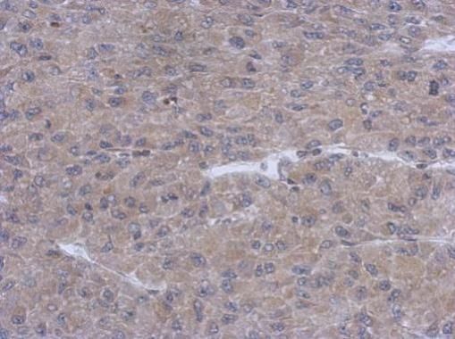 Immunohistochemical analysis of RASGEF1A in paraffin-embedded U87 xenograft using a RASGEF1A polyclonal antibody (Product # PA5-31717) at a dilution of 1:500.