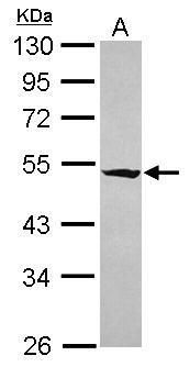 Western blot analysis of RASGEF1A using 30µg of IMR32 lysate. Samples were loaded onto a 10% SDS-PAGE gel and probed with a RASGEF1A polyclonal antibody (Product # PA5-31717) at a dilution of 1:5000.