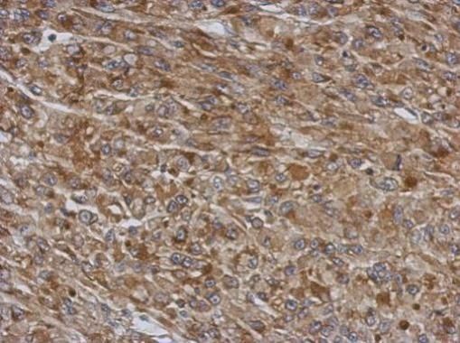 Immunohistochemical analysis of TMCO3 in paraffin-embedded U87 xenograft using a TMCO3 polyclonal antibody (Product # PA5-31741) at a dilution of 1:500.