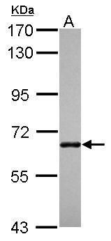 Western blot analysis of ANKRD13B using 30µg of A431 lysate. Samples were loaded onto a 7.5% SDS-PAGE gel and probed with an ANKRD13B polyclonal antibody (Product # PA5-31752) at a dilution of 1:1000.
