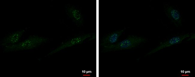 Immunofluorescent analysis of ZXDA showing staining in the nucleus of SK-N-SH cells. SK-N-SH cells were fixed in 4% paraformaldehyde at RT for 15 min and stained using a ZXDA polyclonal antibody (Product # PA5-31856) diluted at 1:500. Blue: Hoechst 33342 staining. Scale bar = 10 ?m.