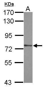 Western blot analysis of ZXDA using 30µg of HeLa lysate. Samples were loaded onto a 7.5% SDS-PAGE gel and probed with a ZXDA polyclonal antibody (Product # PA5-31856) at a dilution of 1:1000.