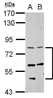 Western blot analysis of CCDC114 using 30µg of A) NT2D1 and B) SK-N-SH lysate. Samples were loaded onto a 7.5% SDS-PAGE gel and probed with a CCDC114 polyclonal antibody (Product # PA5-32115) at a dilution of 1:2000.