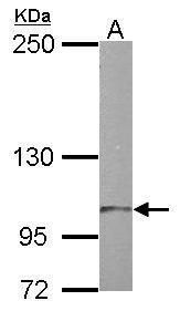 Western blot analysis of TTLL7 using 50µg of mouse brain lysate. Samples were loaded onto a 5% SDS-PAGE gel and probed with a TTLL7 polyclonal antibody (Product # PA5-31807) at a dilution of 1:1000.