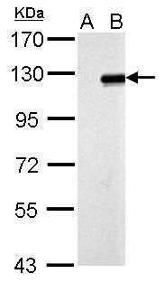 Western blot analysis of ZNF711 using 30µg of A) Non-transfected 293T lysates and B) ZNF711 transfected 293T lysate. Samples were loaded onto a 7.5% SDS-PAGE gel and probed with a ZNF711 polyclonal antibody (Product # PA5-31815) at a dilution of 1:5000.
